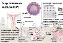 İnsan papilloma virüsü nedir, belirtileri nelerdir ve nasıl tedavi edilir?