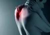 Основні причини виникнення защемлення нерва в плечовому суглобі: симптоми та лікування лікарськими препаратами та народними засобами