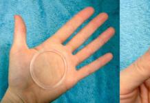 Nuvaring: инструкции за употреба на хормоналния пръстен Nuvaring пръстен странични ефекти