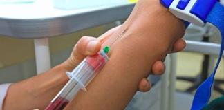 Testovi za klamidiju: vrste, priprema, dekodiranje Što pokazuje krvni test za klamidiju?