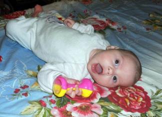 Тортиколис при новородени: лечение, признаци, причини, последствия