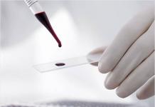 Исследование аллоантител к антигенам эритроцитов Кровь на антитела к эритроцитам