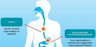 Treatment of high stomach acidity, its causes and symptoms High acidity