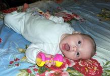 Torticollis ในทารกแรกเกิด: การรักษา สัญญาณ สาเหตุ ผลที่ตามมา